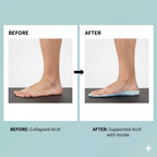 NubeStep Orthotics