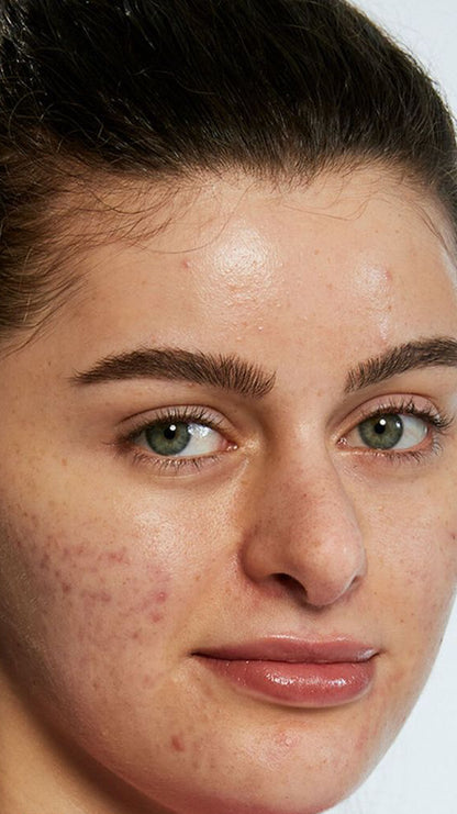 Cicapair Tiger Grass Color Correcting Treatment SPF 30 50ml