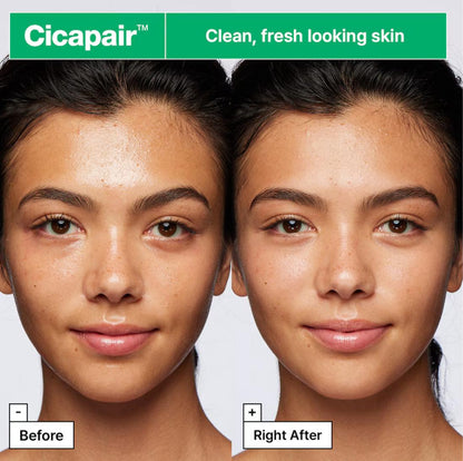 Cicapair Gentle Foam Cleanser For Sensitive Skin